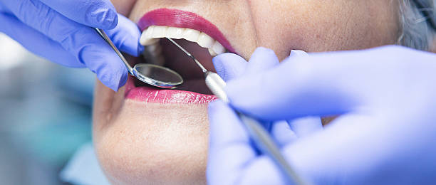 Best Chipped Tooth Repair Near Me  in Mill Neck, NY